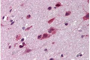 Human Brain Cortex (formalin-fixed, paraffin-embedded) stained with TNIP2 antibody ABIN290395 at 5 ug/ml followed by biotinylated goat anti-rabbit IgG secondary antibody ABIN481713, alkaline phosphatase-streptavidin and chromogen. (TNIP2 抗体)