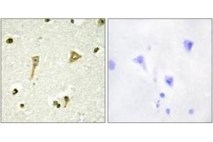 Immunohistochemistry analysis of paraffin-embedded human brain tissue, using TSC22D1 Antibody. (TSC22D1 抗体  (AA 71-120))