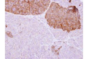 IHC-P Image IL22 Receptor alpha 2 antibody detects IL22RA2 protein at cytosol on PC14 xenograft by immunohistochemical analysis. (IL22RA2 抗体)