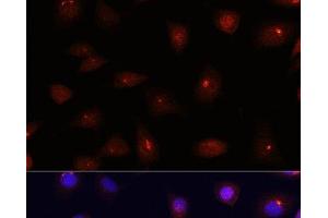 Immunofluorescence (IF) image for anti-Centrin, EF-Hand Protein, 3 (CETN3) antibody (ABIN7264157)