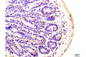 Formalin-fixed and paraffin embedded mouse colon labeled with Anti-ADCY8 Polyclonal Antibody, Unconjugated (ABIN751228) at 1:200 followed by conjugation to the secondary antibody and DAB staining. (ADCY8 抗体  (AA 151-250))