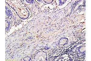 L1 rat lung lysates L2 human colon carcinoma lysates probed with Anti TIMP-1 Polyclonal Antibody, Unconjugatedat 1:200 overnight at 4 °C. (TIMP1 抗体  (AA 131-207))