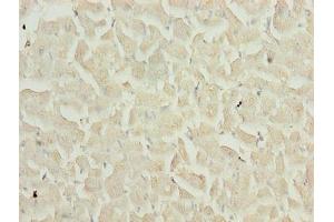 Immunohistochemistry of paraffin-embedded human heart tissue using ABIN7159481 at dilution of 1:100 (TIMP1 抗体  (AA 24-207))