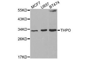 Western blot analysis of extracts of various cell lines, using THPO antibody. (Thrombopoietin 抗体  (AA 22-349))