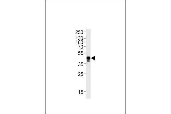 EFNB2A Antikörper  (AA 163-194)