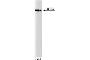 Western blot analysis of PI3-Kinase C2beta on a HeLa lysate. (PIK3C2B 抗体  (AA 16-209))