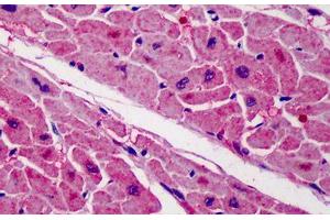 Human Heart: Formalin-Fixed, Paraffin-Embedded (FFPE) (ZBTB7A 抗体  (C-Term))