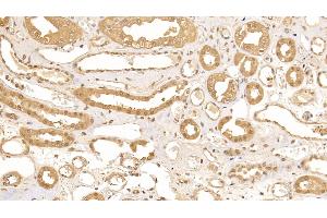Detection of CRYl1 in Human Kidney Tissue using Polyclonal Antibody to Crystallin Lambda 1 (CRYl1) (CRYL1 抗体  (AA 24-232))
