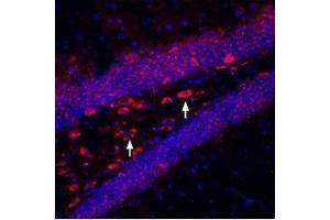 Immunohistochemistry (IHC) image for anti-Potassium Inwardly-Rectifying Channel, Subfamily J, Member 11 (KCNJ11) (AA 372-385), (Intracellular) antibody (ABIN7043472)