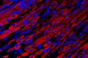 Immunofluorescent analysis of paraformaldehyde-fixed mouse stomach using,NCKAP1 (ABIN7074784) at dilution of 1: 1000 (NCKAP1 抗体)