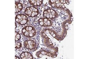 Immunohistochemical staining of human colon with FAM125A polyclonal antibody  shows moderate cytoplasmic and membranous positivity in glandular cells at 1:50-1:200 dilution. (FAM125A 抗体)