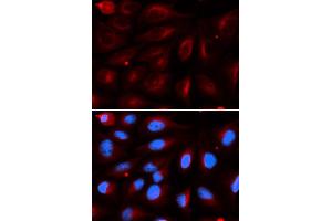 Immunofluorescence (IF) image for anti-Protein Inhibitor of Activated STAT, 2 (PIAS2) antibody (ABIN1876855) (PIAS2 抗体)
