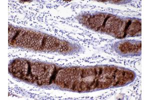 IHC analysis of MUC2 using anti-MUC2 antibody . (MUC2 抗体)