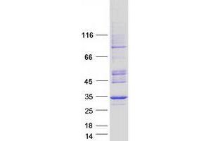 Western Blotting (WB) image for Solute Carrier Family 25 (Mitochondrial Carrier, Adenine Nucleotide Translocator), Member 5 (SLC25A5) protein (Myc-DYKDDDDK Tag) (ABIN2732166)