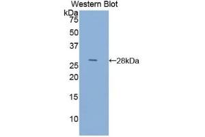 Detection of Recombinant ACTC1, Human using Anti-Actin Alpha 1, Cardiac Muscle (ACTC1) Polyclonal Antibody (ACTC1 抗体  (AA 156-368))