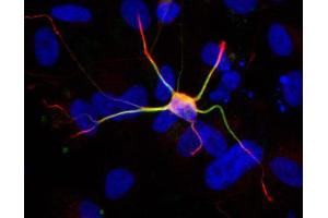 ICC/IF Image Immunofluorescent staining of neurons derived from human ESC with a 1:200 dilution of GeneTex anti-doublecortin antibody, Anti-doublecortin antibody (red) colocalizes with anti-MAP2 antibody (green). (Doublecortin 抗体)