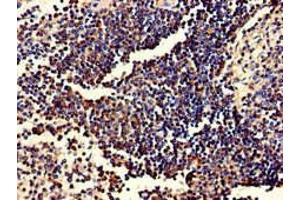Immunohistochemistry of paraffin-embedded human spleen tissue using ABIN7174020 at dilution of 1:100 (Fgr 抗体  (AA 11-72))