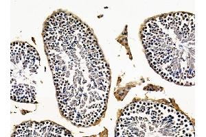 ABIN7096261 and ABIN7100323 at 1/100 staining mouse testis tissue by IHC-P. (SLC25A43 抗体)