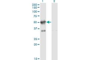 Western Blotting (WB) image for anti-A Kinase (PRKA) Anchor Protein 17A (AKAP17A) (AA 53-157) antibody (ABIN599035) (SFRS17A 抗体  (AA 53-157))