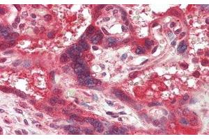 Immunohistochemistry (IHC) image for anti-Coagulation Factor III (thromboplastin, Tissue Factor) (F3) (AA 30-252) antibody (ABIN7427366)
