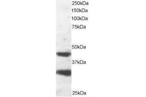 Image no. 1 for anti-Platelet-Activating Factor Acetylhydrolase 1b, Regulatory Subunit 1 (45kDa) (PAFAH1B1) (C-Term) antibody (ABIN374217) (PAFAH1B1 抗体  (C-Term))