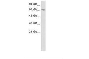 Image no. 1 for anti-Kelch-Like 28 (KLHL28) (AA 380-429) antibody (ABIN202773) (KLHL28 抗体  (AA 380-429))
