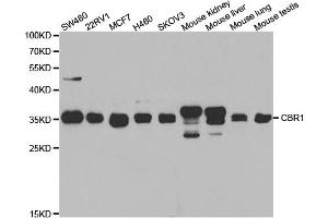 Western blot analysis of extracts of various cell lines, using CBR1 antibody (ABIN5973163) at 1/1000 dilution. (CBR1 抗体)