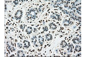 Immunohistochemical staining of paraffin-embedded breast tissue using anti-SSB mouse monoclonal antibody. (SSB 抗体)