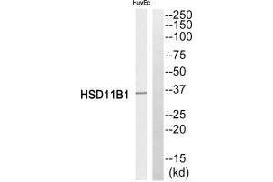 Western blot analysis of extracts from HuvEc cells, using HSD11B1 antibody. (HSD11B1 抗体  (N-Term))