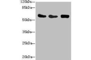 Western blot All lanes: CSRNP2 antibody at 2. (CSRNP2 抗体  (AA 324-543))