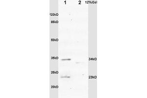 L1 rat brain lysates L2 mouse intestine lysates probed with Anti IGFBP6 Polyclonal Antibody, Unconjugated (ABIN753298) at 1:200 overnight at 4 °C. (IGFBP6 抗体  (AA 141-240))