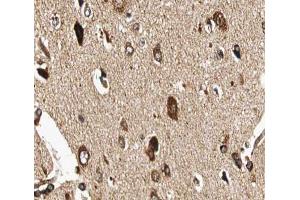 ABIN6266907 at 1/100 staining human brain tissue sections by IHC-P. (GUCY1B3 抗体  (N-Term))