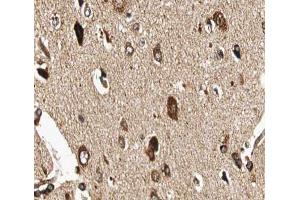 ABIN6266907 at 1/100 staining human brain tissue sections by IHC-P. (GUCY1B3 抗体  (N-Term))