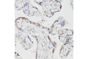 Immunohistochemistry of paraffin-embedded human placenta using SPON2 antibody (ABIN6129679, ABIN6148370, ABIN6148372 and ABIN6215647) at dilution of 1:100 (40x lens). (SPON2 抗体  (AA 27-150))