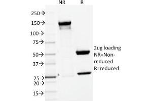 SDS-PAGE Analysis Purified ENAH / MENA Mouse Monoclonal Antibody (ENAH/1988). (ENAH 抗体  (AA 485-589))