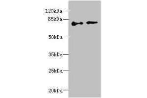 Western blot All lanes: ECD antibody at 6 μg/mL Lane 1: Hela whole cell lysate Lane 2: U251 whole cell lysate Secondary Goat polyclonal to rabbit IgG at 1/10000 dilution Predicted band size: 73, 68, 77 kDa Observed band size: 73 kDa (ECD/SGT1 抗体  (AA 1-300))