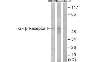 Western blot analysis of extracts from COLO cells and HepG2 cells, using TGF beta Receptor I (epitope around residue 165) antibody. (TGFBR1 抗体  (Ser165))