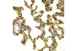 Immunohistochemistry of paraffin-embedded mouse lung using RBBP4 Antibody (ABIN5970697) at dilution of 1/100 (40x lens).