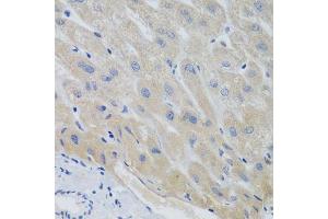Immunohistochemistry of paraffin-embedded human liver using PTTG1 antibody. (PTTG1 抗体  (AA 1-202))