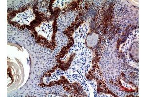Immunohistochemistry (IHC) analysis of paraffin-embedded Human Skin, antibody was diluted at 1:100. (CLEC11A 抗体)