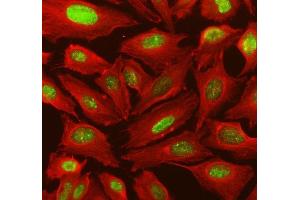 IF analysis of IRF9 using anti-IRF9 antibody (ABIN4886637) and anti-Tubulin Alpha antibody (ABIN7600339). (IRF9 抗体  (AA 1-110))