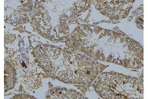 ABIN6269244 at 1/100 staining Mouse testis tissue by IHC-P. (MAP3K8 抗体  (Internal Region))
