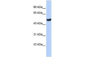 WB Suggested Anti-SEPT11(septin 11) Antibody Titration: 0. (Septin 11 抗体  (N-Term))
