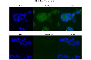 Sample Type: MCF7 Primary Antibody Dilution: 4 µg/mL Secondary Antibody: Anti-rabbit Alexa 546 Secondary Antibody Dilution:  µg/mL   Gene Name: BRCC3 (BRCC3 抗体  (C-Term))