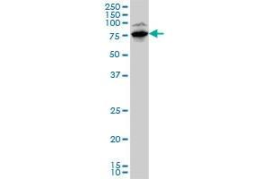LIMK1 monoclonal antibody (M01A), clone 1A8 Western Blot analysis of LIMK1 expression in HepG2 . (LIM Domain Kinase 1 抗体  (AA 548-647))