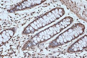 Immunohistochemistry of paraffin-embedded human colon using SRSF3 Rabbit mAb (ABIN7270216) at dilution of 1:100 (40x lens). (SRSF3 抗体)