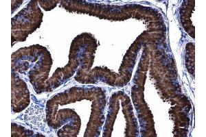 IHC-P Image Grp78 antibody [N2C1], Internal detects Grp78 protein at cytoplasm in rat prostate by immunohistochemical analysis.