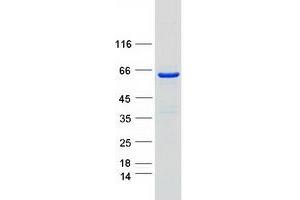 Validation with Western Blot