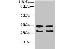 Western blot All lanes: TGFA antibody at 2 μg/mL Lane 1: EC109 whole cell lysate Lane 2: 293T whole cell lysate Secondary Goat polyclonal to rabbit IgG at 1/15000 dilution Predicted band size: 18, 17 kDa Observed band size: 30, 35 kDa (TGFA 抗体  (AA 40-89))