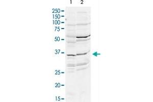 Western Blot analysis of mouse WT brain (A) and rat brain (B) tissue lysates with DLX2 polyclonal antibody  at 2 ug/mL working concentration.